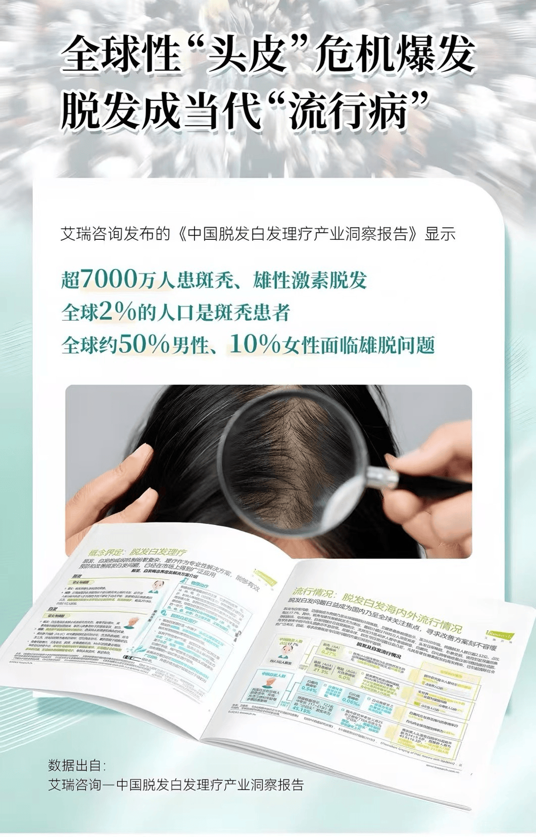 国际脱发研究最新进展及绿色治疗探索🌱🔍
